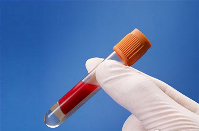 瘦人(rén)也(yě)會(huì)得(de)高(gāo)脂血症！這(zhè)四類人(rén)群應重點關注血脂水(shuǐ)平！